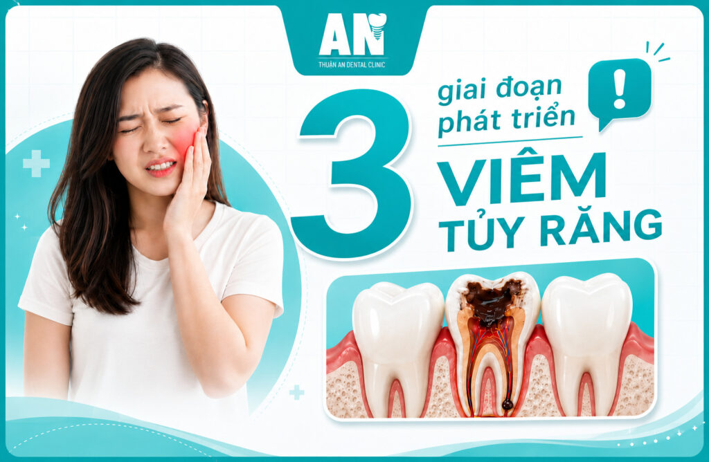 3 Giai đoạn phát triển viêm tủy răng