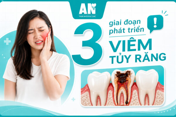 3 Giai đoạn phát triển viêm tủy răng