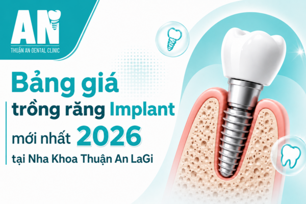 Bảng giá trồng răng Implant mới nhất 2026 tại Nha Khoa Thuận An LaGi