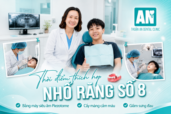 Thời điểm thích hợp nhỏ răng số 8