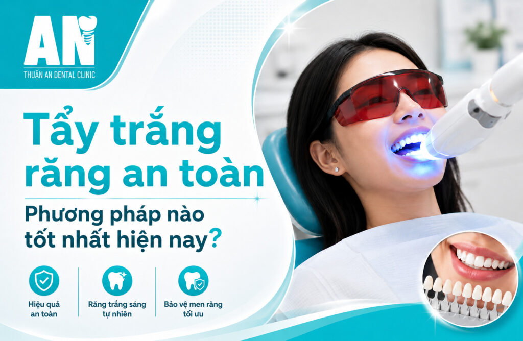 Tẩy trắng răng có hại men răng không? Sự thật cần biết