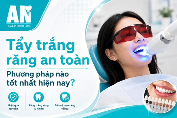 Tẩy trắng răng có hại men răng không? Sự thật cần biết