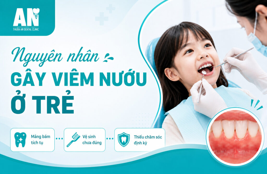 Viêm nướu răng: Nguyên nhân, triệu chứng và cách điều trị hiệu quả