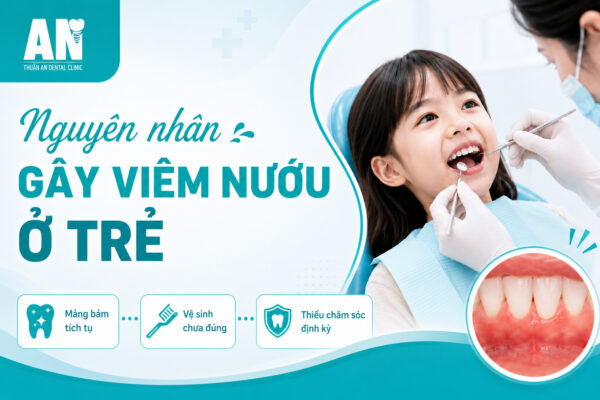 Viêm nướu răng: Nguyên nhân, triệu chứng và cách điều trị hiệu quả